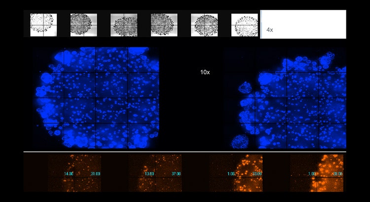 在基质胶中培养的活类器官的自动化成像，放大倍数为 4x 或 10x