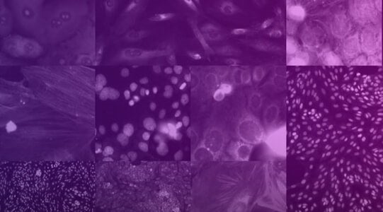 Recursion 为 COVID-19 治疗研究生成可公开可用的最大人体细胞形态数据集