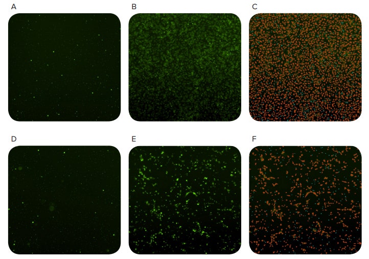 Tracking cell migration using the MiniMax cytometer