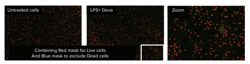 LPS + Dexamethasone treated PBMC