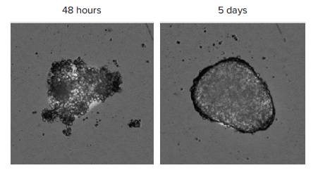 Spheroids imaged in the TL channel of the MiniMax cytometer