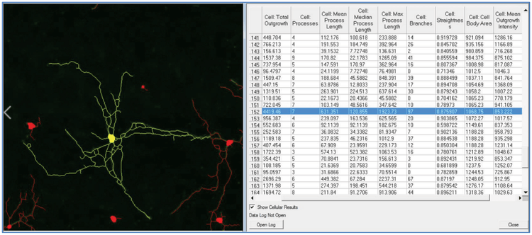 Neurite processes measurements