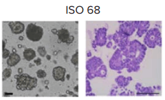 Patient derived CRC organoid