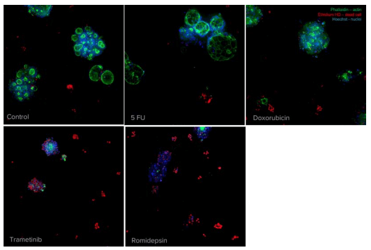 Phenotypic changes in CRC organoids