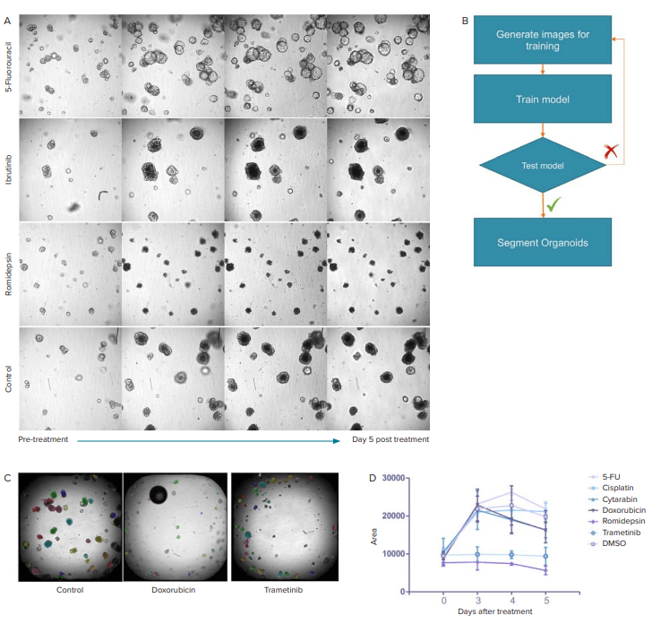 Example images of CRC organoids in Matrigel