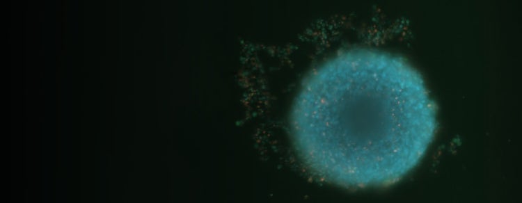 Cell culture automation