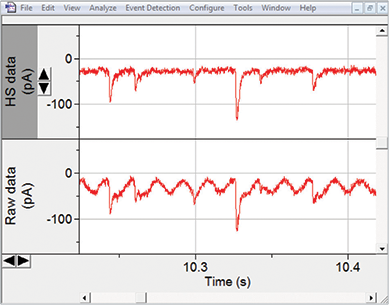 HumSilencer (HS) - accurate signal measurement in whole-cell recordings
