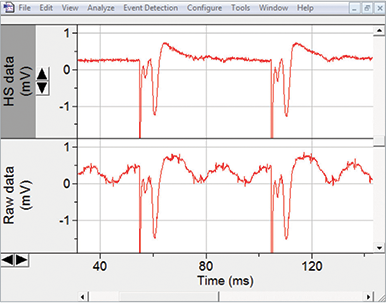 umSilencer-subtracted data in top panel, raw data in bottom