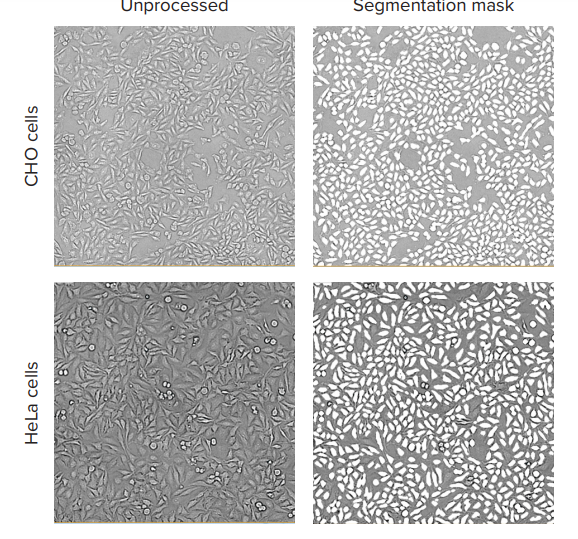 TL images and the software analysis