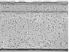Neurons in OrganoPlate