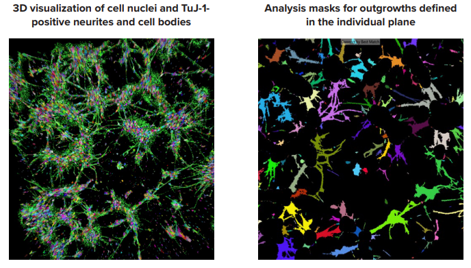3D evaluation of cells and networks in hydrogel by MetaXpress software
