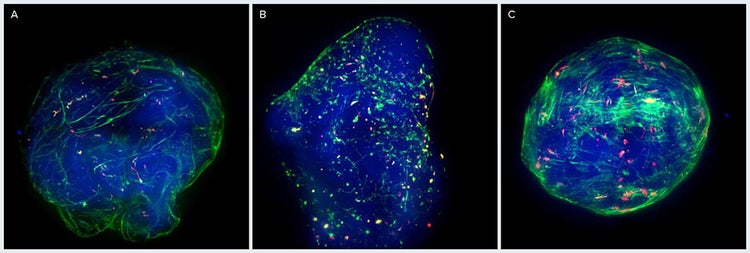 Overlays of 2D projections of fluorescent channels of 3D brain micro-tissues
