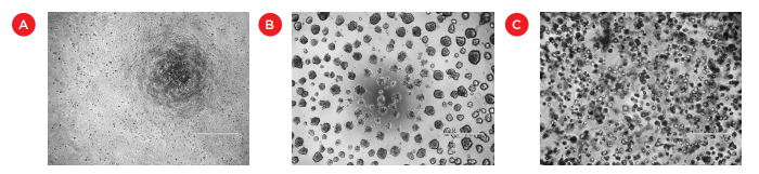 Images of HCT 116 cells grown in standard monolayer cultures