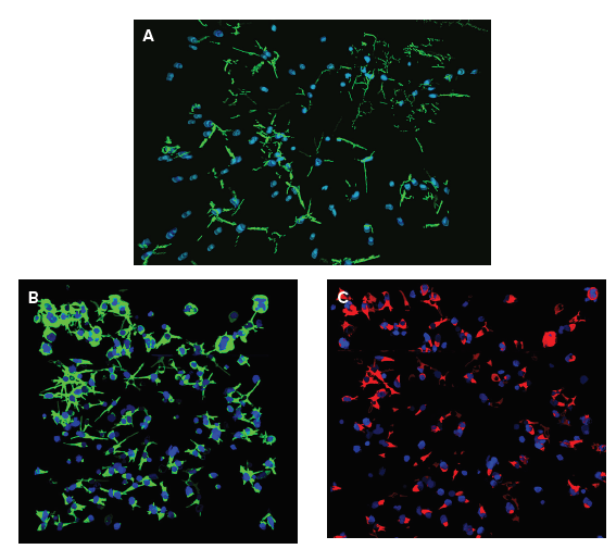 3D analysis of neurite networks