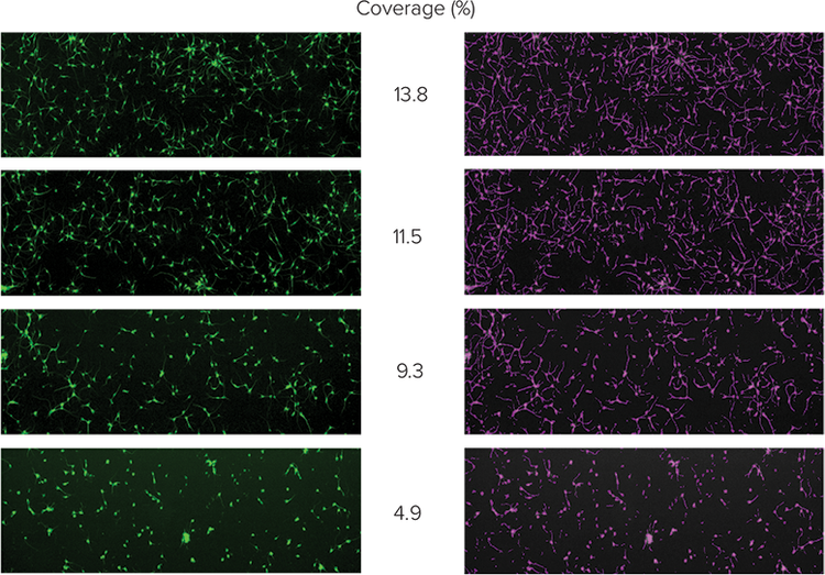 Retinoic acid causes dose-dependent inhibition of neurite outgrowth