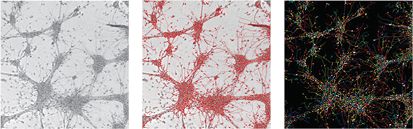 Transmitted light projection images and overlaying analysis masks for neuronal detection