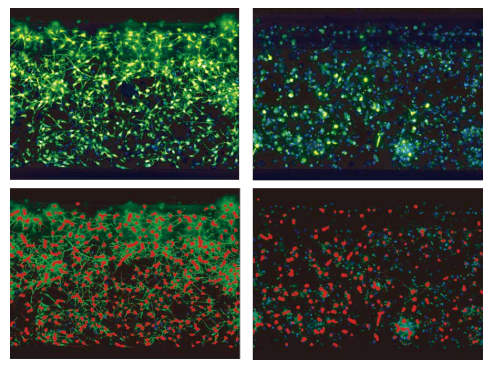 2D analysis of neural networks