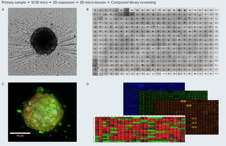 Tumoroids formed 48h after plating