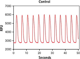 Untreated control iPSC cardiomyocytes