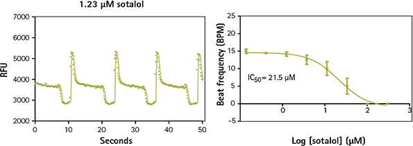 iPSC cardiomyocytes treated with sotalol show decreased beat frequency and altered beat pattern