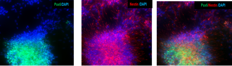iPSC 源性神经前体细胞表达神经前体标记物 PAX6 和 Nestin