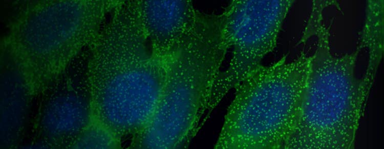 ELISA to epigenetics with HTRF