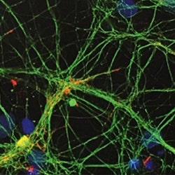 Spheroids