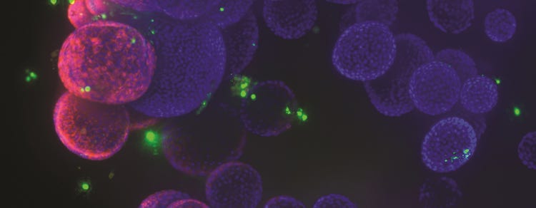 Organoids