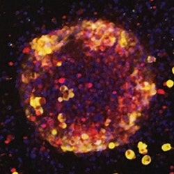 Spheroids