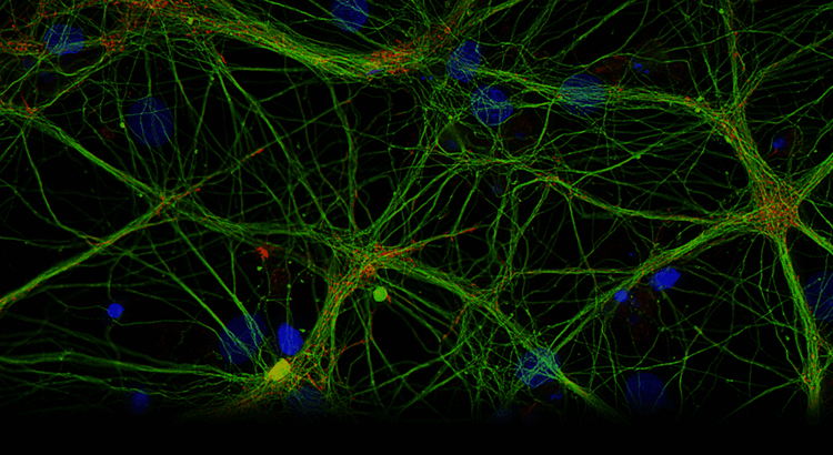Quantitate Neuron Potential
