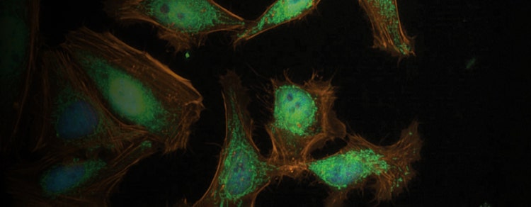 Neurite Outgrowth