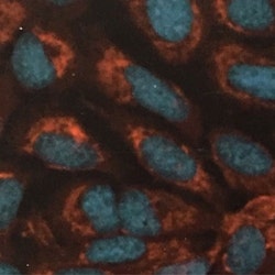 Spheroids