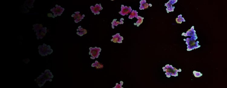 organoid cultivation