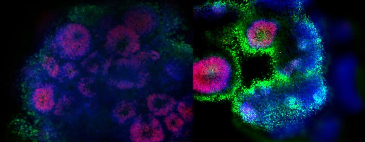 3D cerebral organoids