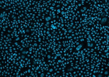 CHO cells