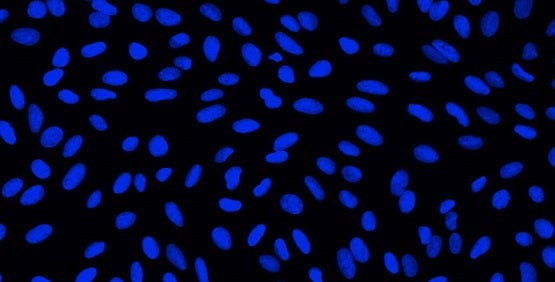 Nucleus