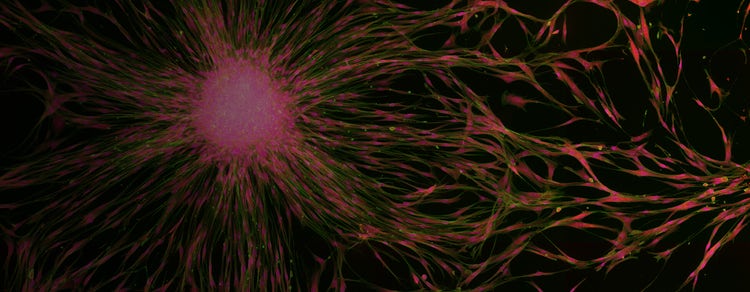 High-content and Automated Imaging
