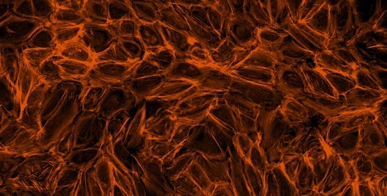 F-actin cytoskeleton