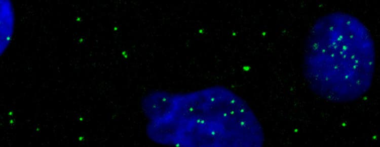 Viral Infection and Therapeutics Webinar
