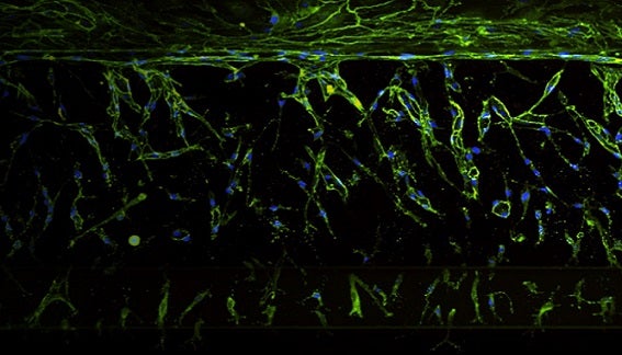 3D Disease Models