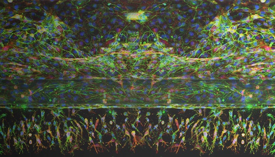 Automation of the organ-on a chip assay: automated culture, imaging and analysis of…
