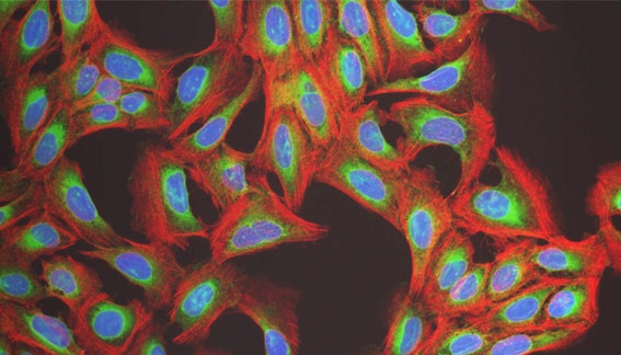 Phenotypic profiling based on the Cell Painting assay