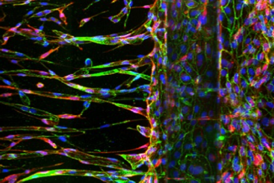 3D image analysis