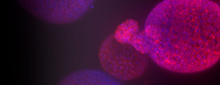 Organoid