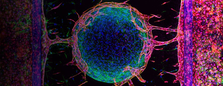 Organ-On-A-Chip
