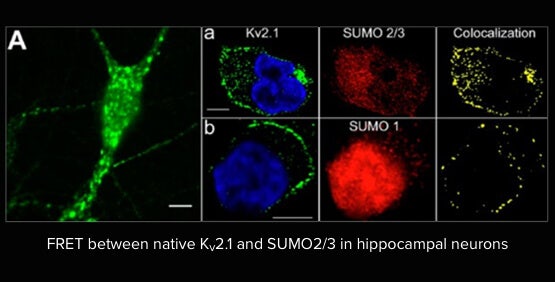 同步电生理学和影像学研究