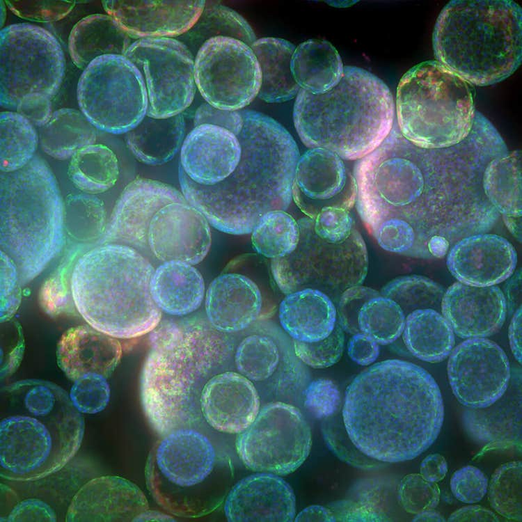 通过 In Carta 获得 ImageXpress Confocal HT.ai 智能化共聚焦高内涵成像分析系统上的类器官图像