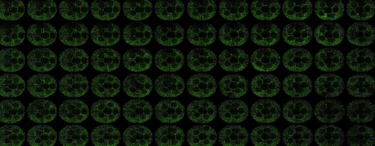 Liver-Derived Organoids
