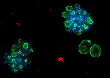 3D Ready Organoid