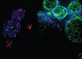 3D Ready Organoids